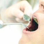 歯周病を予防するため定期的に歯石をとってもらっています＜体験談＞