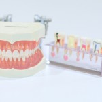 歯周ポケットが深くなりやすい場所を知ることで歯周病から歯を守る＜体験談＞