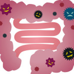 腸内環境を整えて口臭予防＜体験談＞