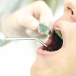 歯周病はどうやって治療していく？歯周病の段階に合わせた治療内容