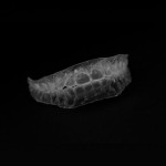 あきらめないで！大人になっても歯科矯正はできます！