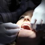 痛いのはイヤ！歯石除去の痛みってガマンするしかないの？