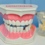 前歯のギザギザの原因は？治せるの？
