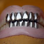 銀歯とセラミック、どちらを選ぶ？それぞれのメリット・デメリットを比較研究！