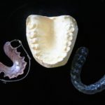 大人の歯科矯正、どんな種類があるの？