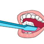虫歯になりやすい歯・なりにくい歯はどれ？