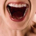 気になる奥歯の銀歯。保険適用で「白い歯」にできるって知ってた？